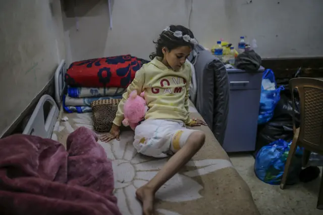 صورة أرشيفية لهبة مهنّا، وهي طفلة فلسطينية خسرت ساقها ووالدها في غارة إسرائيلية بمخيم النصيرات وسط القطاع (ديسمبر/كانون الأول 2024)
