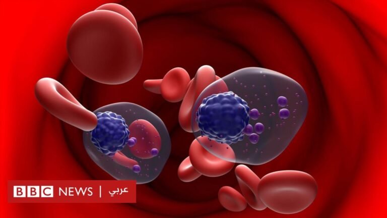 قصة “حصان طروادة” المعتمَد حديثاً في المملكة المتحدة لعلاج سرطان خلايا البلازما A28d88c0 4919 11f0 b71a 9b7883eed920.jpg